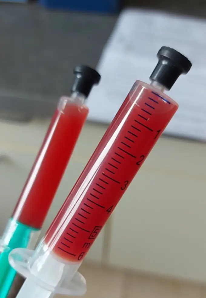 Blutprobe im Labor